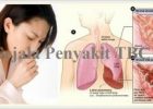 Mengatasi Penyakit TBC Dan Paru-Paru