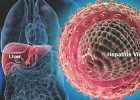 Cara Cepat Sembuhkan Penyakit Hepatitis/Liver Dengan Propolis Asli